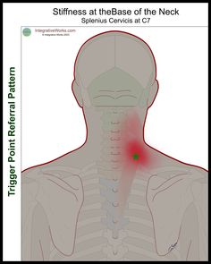 Pain at the Base of the Neck When Turning - Integrative Works Stiff Neck, Your Head, Anatomy, Self Care, Turning