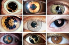 multiple pictures of different colored eyes with their reflection in the eyelide and iris area