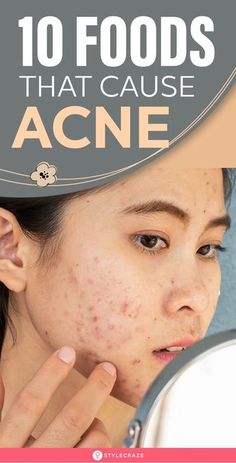 Acne Causing Foods, Foods For Clear Skin, Back Acne Remedies, Remove Skin Tags Naturally, Baking Soda Shampoo, Natural Cold Remedies, Acne Solutions, Natural Cough Remedies, Face Acne