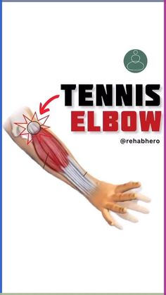 the tennis elbow is shown with an arrow pointing to it's wrist and hand