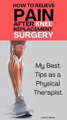 Why is there so Much Pain After Knee Replacement surgery? What you can do? Natural remedies? Exercices? Recovery Time? My best tips as a physical therapist! #KneeSurgery #KneeReplacement #PainRelief Knee Replacement Pain, After Knee Replacement Surgery, Knee Replacement Surgery Recovery, Knee Replacement Exercises, Knee Replacement Recovery, Knee Pain Relief Remedies, Knee Surgery Recovery, Knee Pain Relief Exercises, Bad Knee Workout