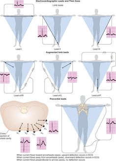 Electrophysiology Of The Heart, Lead Placement, Ekg Leads, Paramedic School, Parts Of The Heart, Critical Care Nursing