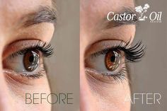 Try castor oil to make your eyelashes stunningly thicker. With simple steps and tips to use it, you're on your way to gorgeous eyes that get you noticed. Caster Oil Eyelashes Before And After, Castor Oil For Lashes Before And After, How To Apply Castor Oil To Eyelashes, Castor Oil Lashes Before After, Castor Oil Eyelashes Before And After, Castor Oil Before And After, Castor Oil For Eyelashes, Oil For Eyelash Growth, Healthy Eyelashes