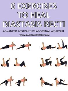 six exercises to heal and det from diastasis recti in 6 easy steps