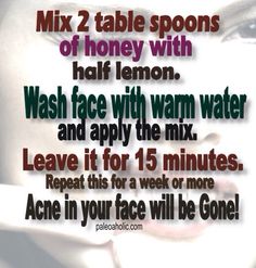 Natural Remedy for Acne Remedy For Acne, Brandy Snap, Acne Medication, Acne Help, Natural Acne Remedies, Fitness Apps, Beauty Remedies, Skin Secrets, Acne Remedies