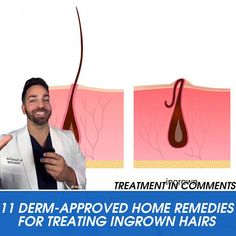 Infected Ingrown Hair, Treat Ingrown Hair, Ingrown Hair Remedies, Cystic Acne Remedies, Remedies For Glowing Skin, Ingrown Hair Removal, Chin Hair, Prevent Ingrown Hairs, Dry Skin Remedies