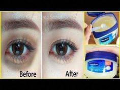 In this video I will share with youApply Vaseline on Your Under Eye Dark Circles and See the Magic,amazing Beauty Hacks with Vaseline.If You like this video ... Under Eye Dark Circles, Eye Dark Circles, Vaseline Original, Vaseline Beauty Tips, Dark Eye Circles, Resep Diet, Remove Dark Circles, Dark Circles Under Eyes, Dark Under Eye