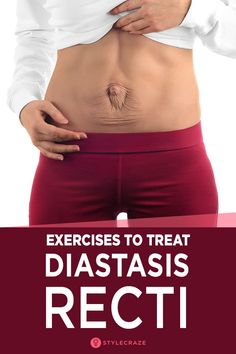 a woman with her stomach exposed and the words exercises to treat diastasis recti