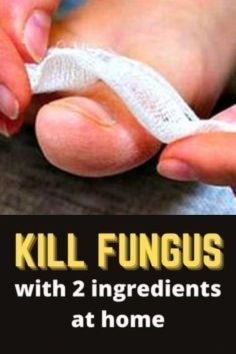 Homemade Nail polish kills fungus instantly!#fungusproblem #killsnail #treatmentfungus #nailfungus #toenailfungus #fungus #fungustretment #fungustoenail Homemade Nail Polish, Nail Care Diy, Nail Problems