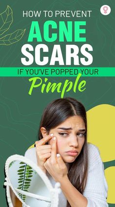 To be very honest, we are all guilty of popping at least one or two pimples in our lifetime. The truth is that popping your zits is highly tempting. Pimple Under The Skin, Blind Pimple, Healthy Skin Care Routine, Pimples Under The Skin, Acne Scarring, Prevent Pimples, Natural Acne Remedies, Instagram Dp