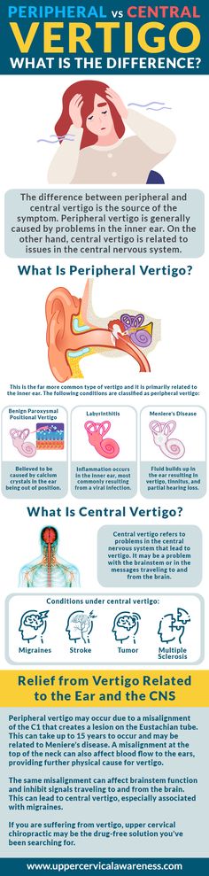 Vertigo Causes, Vertigo Exercises, Vertigo Relief, Vertigo Remedies, Check And Balance, Migraine Headaches, Central Nervous System, Natural Remedy