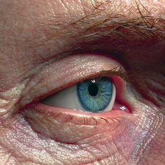 an eye with blue and white iris looking at the camera, close up view from below