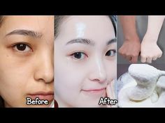 Japanese secret to whitening skin and get rid of pigmentation to get a fresh complexion - YouTube Potato For Skin, Skin Lightening Diy, White Skin Tone, Whitening Cream For Face, Clear Healthy Skin, Glowing Skin Mask