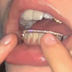 Bottom Teeth, Braces, We Heart It, Diamonds, Lost, Pink