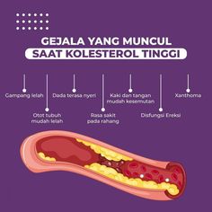 Kolestrol tinggi gak boleh disepelein... Yuk segera atasi... Extrak Pinus Merah ahlinya... tersedia di Pinera 57 (penerobos pembuluh darah menyempit) *Info Pemesanan : 081322251251 Gak Boleh