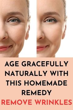 age gracefully naturally with this homemade remedy remove wrinkles Deep Wrinkles, Sagging Skin