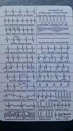 Ekg Rhythms, Paramedic School, Medical Student Study, Cardiac Nursing, Critical Care Nursing