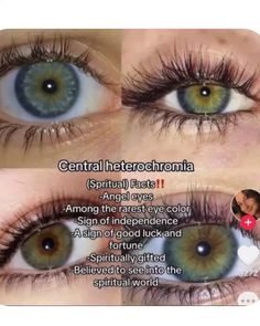 Green Eyes Vs Blue Eyes, Different Types Of Eye Colors, Green Heterochromia Eyes, Central Heterochromia Eyes Green Blue, Rare Eye Colors Unique, Types Of Green Eyes, Prettiest Eye Color, Hazle Eyes, Green Eyes Facts