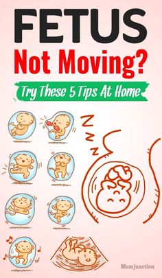 Fetus Not Moving? Try These 5 Tips At Home : The first time the baby kicks is a thrilling and exciting moment for most mothers, one that they would like to experience again and again. #pregnancy #pregnancycare #pregnant #baby #womb #fetus Baby In Womb, Fetal Movement, Pregnant Baby, Happy Pregnancy, Pregnancy Guide, Baby Kicking, Mom Junction