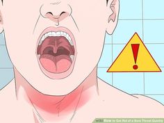 How to Get Rid of a Sore Throat Quickly (with Pictures) - wikiHow Burning Throat, Scratchy Throat