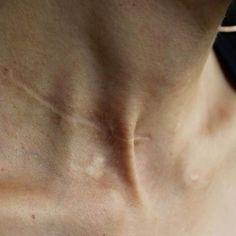 the back of a woman's neck with wrinkles