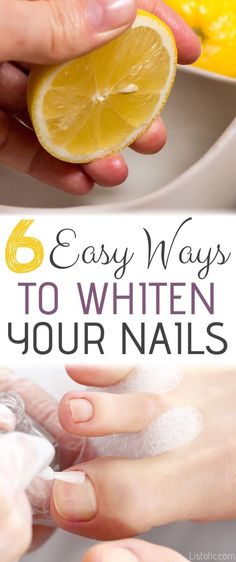 Nail Whitening, Paznokcie Hello Kitty, Diy Pedicure, Baking Soda And Lemon, Pedicure Colors, Pedicure At Home, Pedicure Designs, Baking Soda Shampoo, Diy Baking