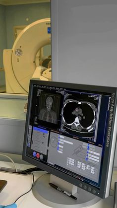 a computer screen with an x - ray image on it