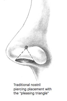 an image of a diagram of the pelvical and its corresponding attachments