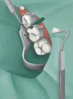 Tooth Illustration, Dental Cover, Tooth Anatomy, Cavity Filling, Dental Advertising, Tooth Filling