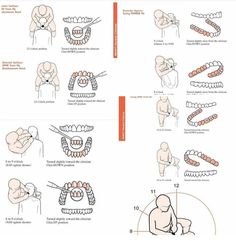 Dental Assistant Suctioning, Dental Notes, Dental Pictures