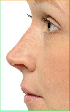 a woman with freckles on her face looking to the side while she's nose is open