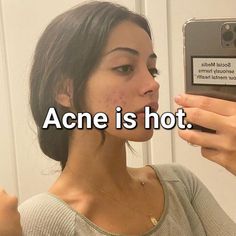 Skin Care Routine Oily Skin, Girl With Acne, Make Skin Glow, Long Natural Curly Hair, Oily Skin Remedy, Bad Acne, Facial Skin Care Routine, Love Your Skin, Skin Glow