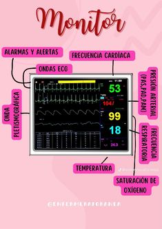 a medical monitor with the words in spanish on it and an image of heartbeats