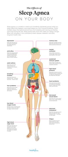 Ms Project, Insomnia Causes, Muscle Weakness, How To Get Sleep, The Human Body, Insomnia, Better Sleep, The Body