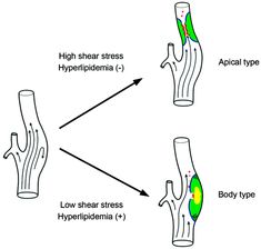 the stages of hypopidia and how they work