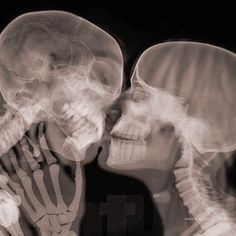 an x - ray image of two people kissing in front of a skeleton's head