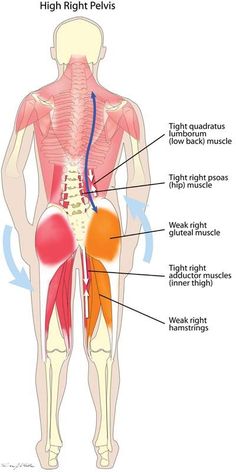 High Hip Muscle Imbalance- exactly my problem at every chiropractic appointment!!! Misaligned Pelvis, Punkty Spustowe, Yoga Anatomy, Tight Hip Flexors, Muscle Imbalance, Muscle Anatomy, Hip Muscles, Tight Hips, Hip Pain