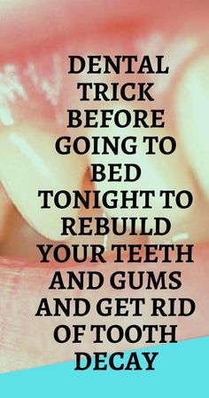 Natural Way To Treat Receding Gums Naturally At Home. #dentist #receding gums #OralHygieneCare #WhatAreOralCare #WhatIsOralCare #HowToCareForOralHealth #WhyOralCareIsImportantForElderly #OralDentalCare #WhyIsOralHealthCareImportant Fix Receding Gums, Reverse Cavities, I Healed, Before Going To Bed