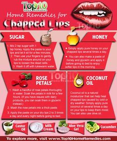 Natural @Home Chapped lips remedies Remedies For Chapped Lips, Lips Remedies, Sore Lips, Diy Lip Scrub, Diy Halloween Dekoration, Top 10 Home Remedies