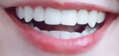 Fang Teeth Natural Aesthetic, Fang Teeth Aesthetic, Perfect Teeth Aesthetic Vampire, Teeth With Natural Fangs, Lips Claims For Dr, Eyelash Claims For Dr, Lip Claims For Dr, Natural Vampire Teeth, Natural Fangs Teeth