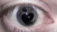 an extreme close up shot of the eye of a person with dark circles on their iris