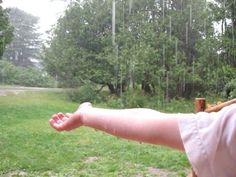 a person is holding out their arm in the rain with trees and grass behind them