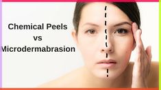 Best microdermabrasion reviews - How does a microdermabrasion at home machine work? What are the benefits of microdermabrasion vs chemical peels ? Microdermabrasion Benefits, Skin Peeling On Face, Face Peel Mask, Facelift Procedure, Diamond Microdermabrasion, Home Microdermabrasion, Deep Cleansing Facial, Acne Problem, Beauty Therapy