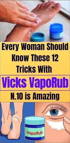 12 Unexpected but Great Uses for Vicks VapoRub Vicks Vapor Rub, Vicks Vapor, Vicks Vaporub Uses, Uses For Vicks, Vapor Rub, Health Signs, Vicks Vaporub, We Are The World, Lose 40 Pounds