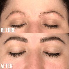 Nourish and define your eyebrows with Luxe Eyebrow Serum. Experience the elegance of enhanced natural beauty with our premium eyebrow growth serum Best Eyebrow Growth Serum, Thicker Brows, Thicker Eyebrows Naturally, Perfect Eyebrow Makeup, Tattoo Eyebrows, Fuller Eyebrows, Eyebrow Growth Serum, Skin Moles, Eyebrow Serum