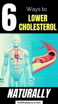 Having high cholesterol levels can be troubling. The best practice going forward is to lower them to manageable levels. Read more inside! Ways To Lower Cholesterol, Lower Cholesterol Naturally, To Lower Cholesterol, Lower Ldl Cholesterol, High Cholesterol Levels, Cholesterol Remedies, Cholesterol Lowering Foods, Lower Your Cholesterol, Cholesterol Diet