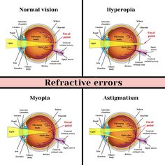 the different areas of an eye that are labeled in this diagram, and what they look like