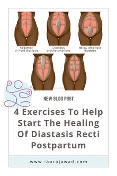 four stages to help start the health of diastasis recti postpartum