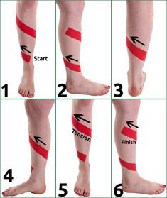 Athletic Training Sports Medicine, Shin Splint Exercises, Volleyball Tips, Shin Splints