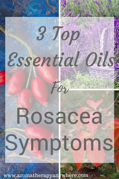 Essential Oil Spray Recipes, Top Essential Oils, List Of Essential Oils, Yl Essential Oils, Living Essentials Oils, Using Essential Oils, Diy Essential Oils, Diy Skincare